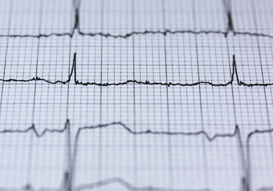 Electrocard_Marketing